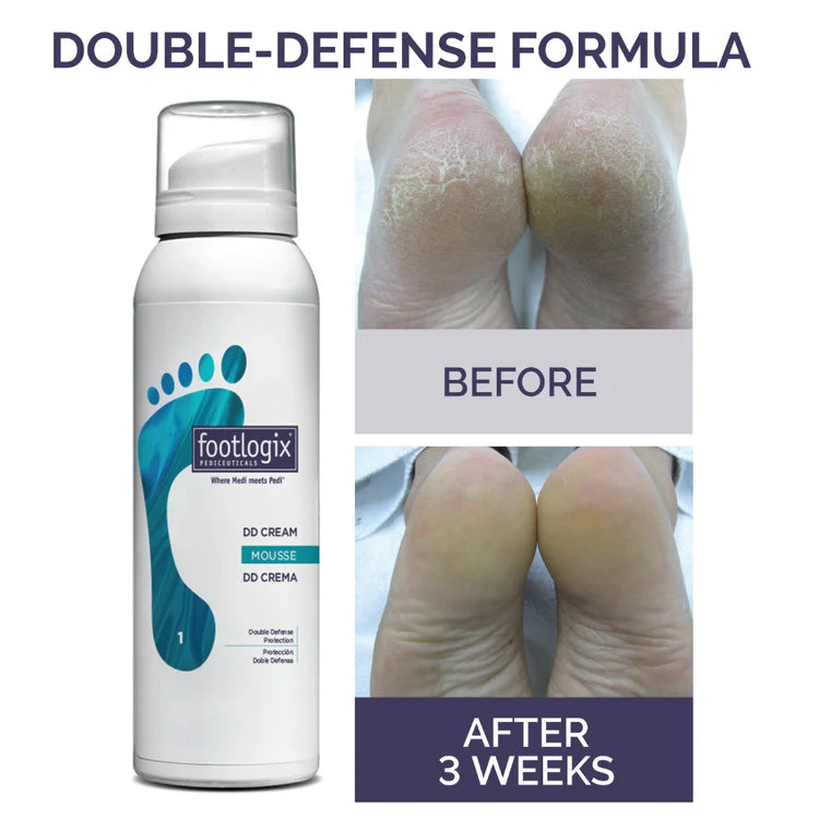 Footlogix DD Cream Mousse Formula